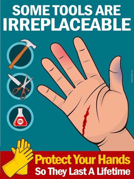 laceration safety posters